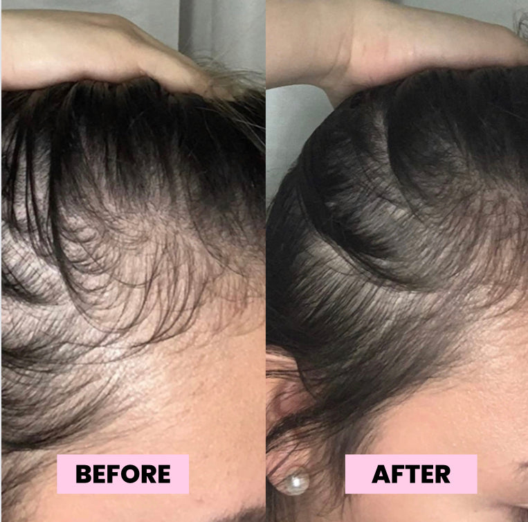 10 Minute Miracle Hair Mask